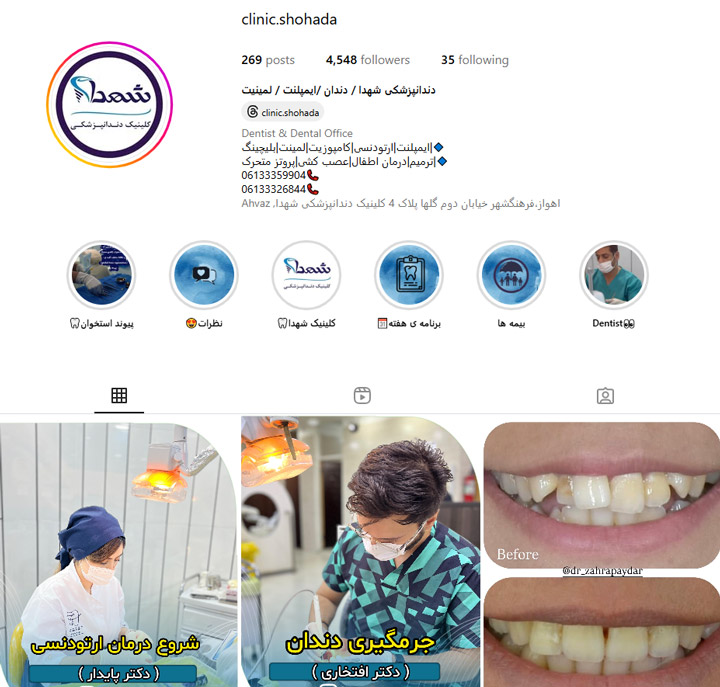 ایمپلنت دیجیتالی دندان